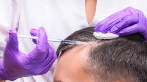 PRP Hair Treatment in Dwarka: A Complete Guide