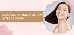 Scalp Micropigmentation After 10 Years