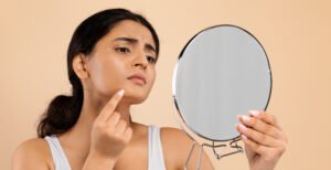 DEFINITIVE STRATEGIES FOR BANISHING PIMPLES AND ENHANCING SKIN RADIANCE