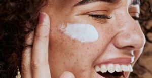 BEST TREATMENT FOR MELASMA ON FACE: TIPS TO PREVENT AND TREAT EFFECTIVELY