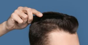 HAIR REGROWTH FOR MEN: CAN YOU REALLY GET YOUR HAIR BACK?
