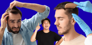 Best Hair Transplant Clinic in Delhi