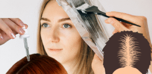 Hair Transplant in Delhi – Get Natural Results with Dermaheal