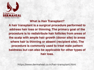 Best Dermatologist in Dwarka: How to Choose the Right Skin Specialist | Dermaheal