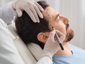 Hair Transplant Dwarka: Top Results