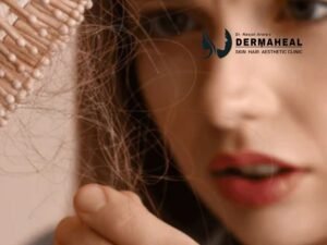 7 Powerful Benefits of Hair Loss Treatment in Dwarka