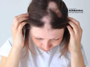 Best Hair Loss Treatment for Natural Hair Regrowth