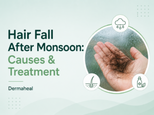 Why Does Hair Fall After Monsoon? Causes, Prevention & Effective Treatments | Dermaheal
