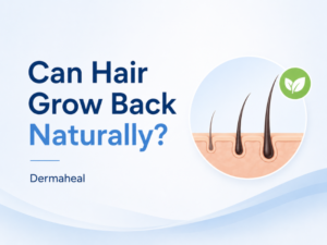 Can Hair Grow Back Naturally? Causes of Hair Loss & Best Treatment Options in Dwarka | Dermaheal