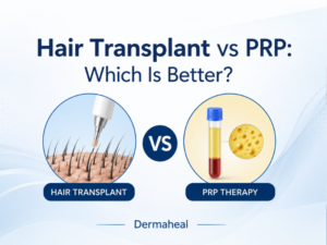 Is Hair Transplant Better Than PRP? Dermatologist Explains Which Treatment Is Right for You | Dermaheal