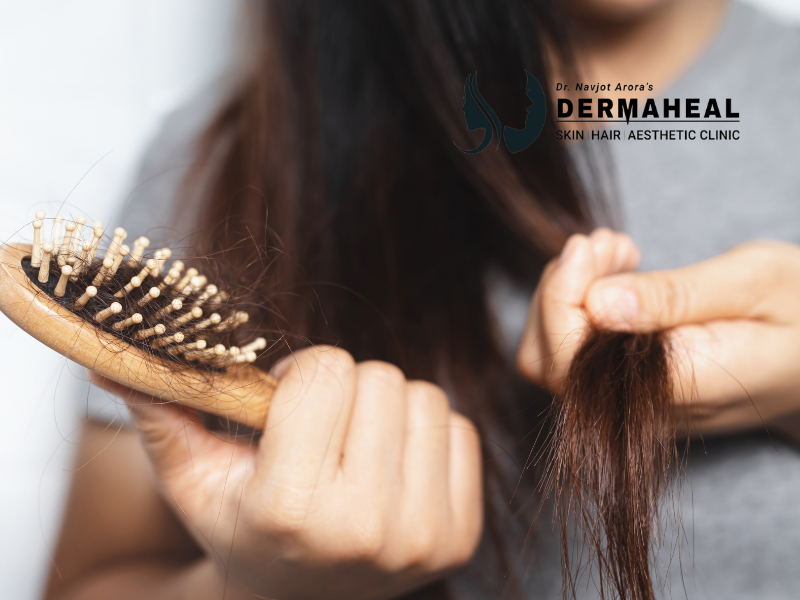 Hair Loss