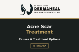 Acne Scars: What Causes Them and Which Treatment May Be Right for Your Skin?