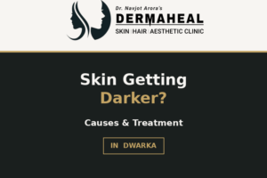 Why Is Your Skin Getting Darker? Common Causes of Pigmentation and When to See a Dermatologist