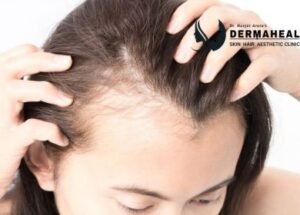 Can Hair Thinning Be Reversed? Causes, Early Signs and Treatment Options