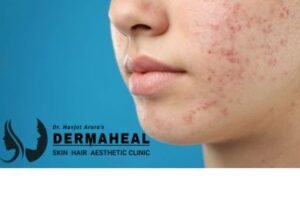 What Causes Persistent Facial Redness and When Should You See a Dermatologist?
