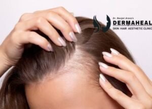 Hair Loss in Women: Common Causes and When to Seek Dermatologist Care